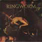Ringworm - Amputee